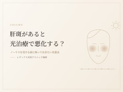 肝斑があると光治療で悪化する？ノーリスを受ける前に知っておきたい注意点