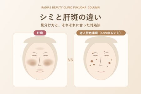 シミと肝斑の違い｜見分け方と、それぞれに合った対処法