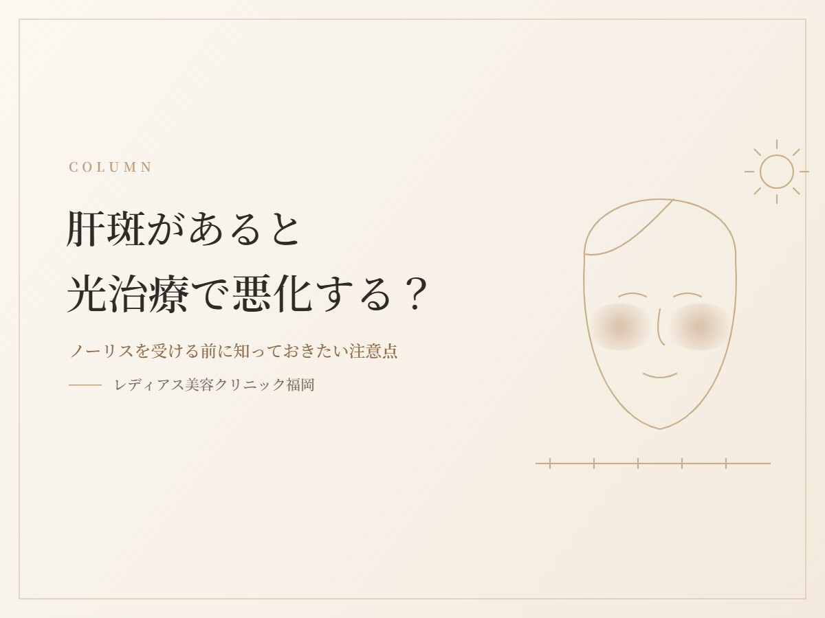 肝斑があると光治療で悪化する？ノーリスを受ける前に知っておきたい注意点