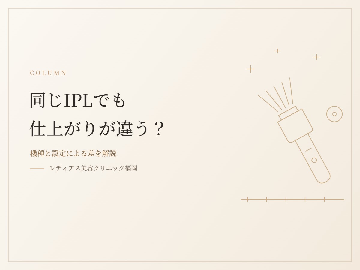 同じIPLでも仕上がりが違うのはなぜ？機種と設定による差を解説します