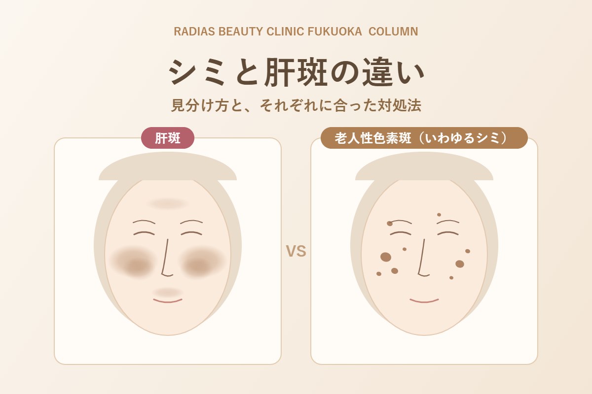 シミと肝斑の違い｜見分け方と、それぞれに合った対処法