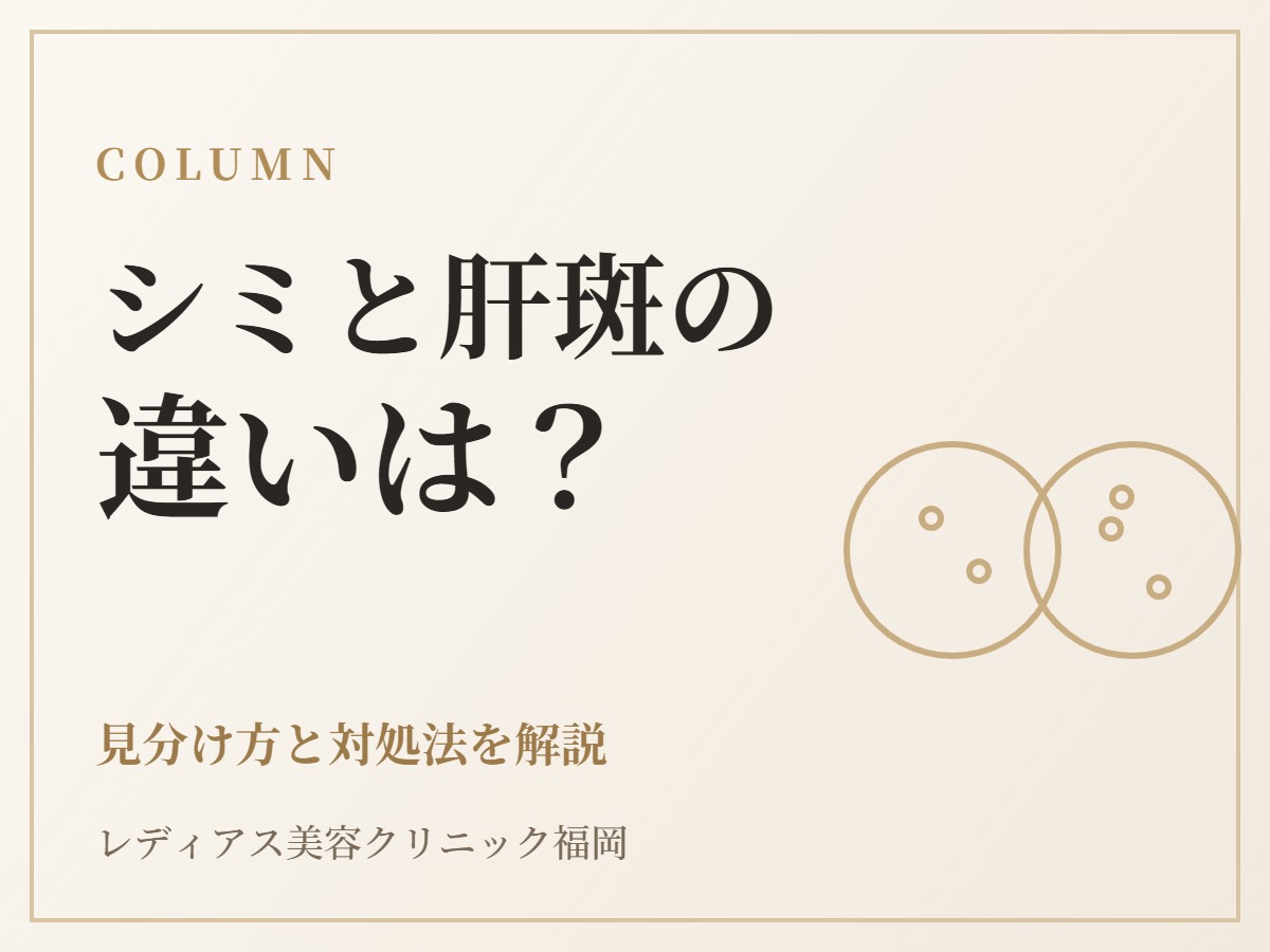 シミと肝斑の違いは？見分け方と、それぞれに合った対処法
